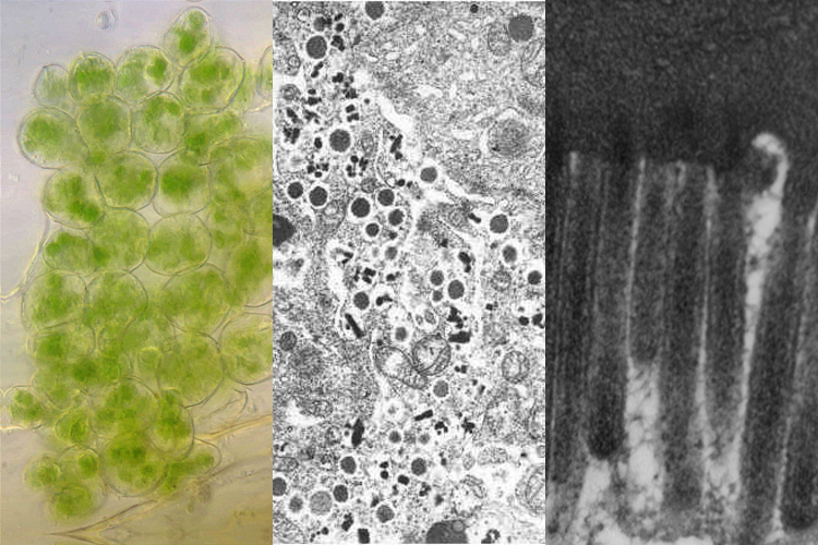 Plant Cell Organelles