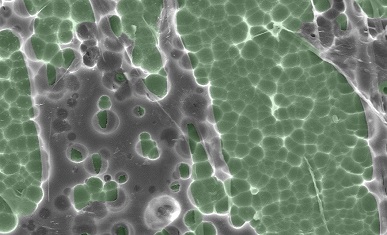 The Plastic Can Be Turned Into Protein Powder